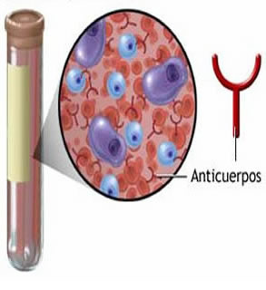 alergia ocular